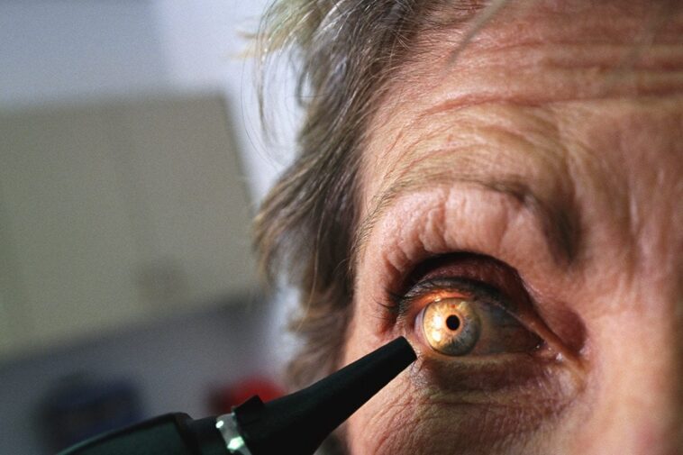 What Are Cataracts? Know Types, Symptoms And Treatment
