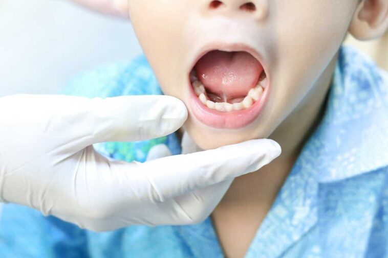 5 Diseases Doctors Can Diagnose After Looking at the Tongue of Patient